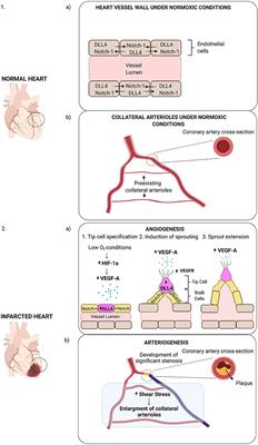 Extracellular Vesicle miRNAs in the Promotion of Cardiac Neovascularisation